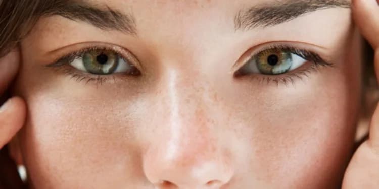 Acne-Prone Skin: Which Natural Oils to Choose Without Worsening Breakouts?
